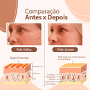 Bálsamo Derol Anti Rugas e Linhas de Expressão