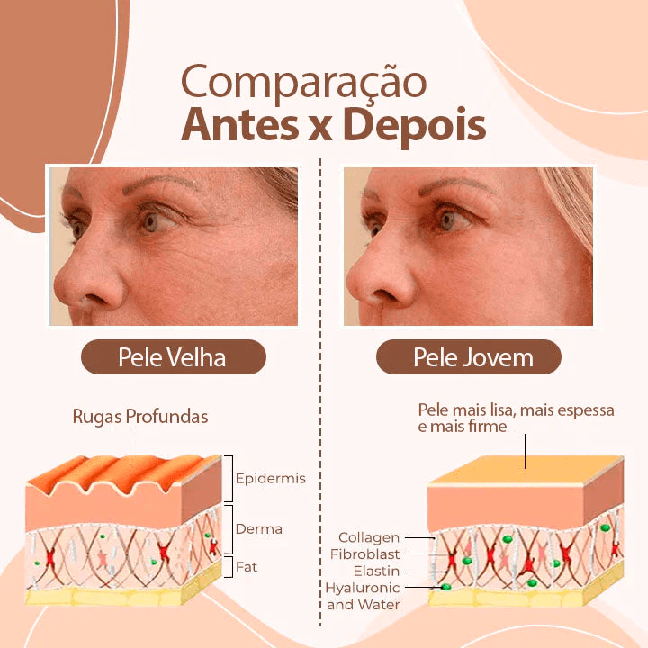 Bálsamo Derol Anti Rugas e Linhas de Expressão